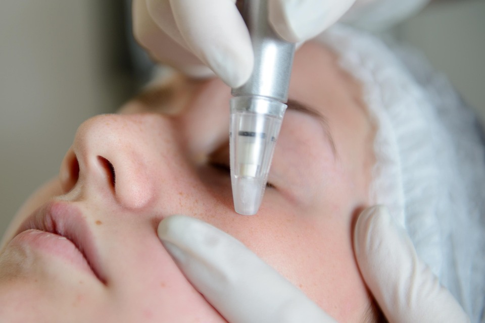 Microdermabrasion Costs and Results: Your Expert Guide to Glowing Skin