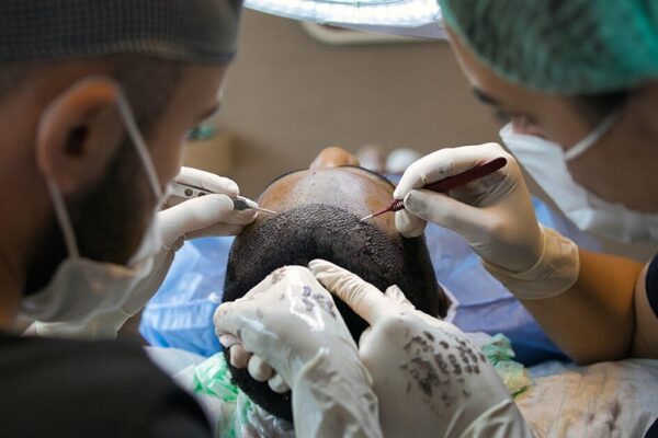 Scalp Massage for Hair Growth: Science-Backed Ways to Relax & Results